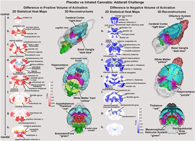 Chronic exposure to inhaled vaporized cannabis high in Δ9-THC suppresses Adderall-induced brain activity
